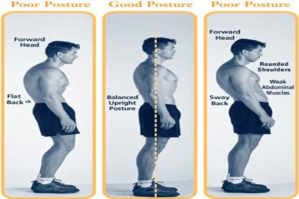 Poor Posture