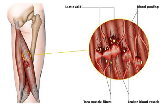 02 (1) SOFT TISSUE RELEASE