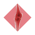 overlay knee